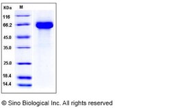 Sino Biological Influenza A H2N2 (A/Canada/720/2005) Hemagglutinin Protein