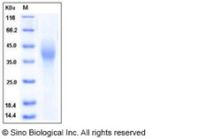 Sino Biological Human SLAMF7 / CRACC / CD319 Protein (ECD, His Tag) 100ug,