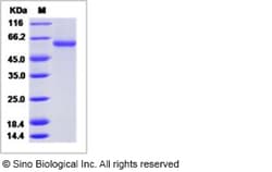 Sino Biological Influenza A H1N1 (A/WSN/1933) Hemagglutinin / HA Protein