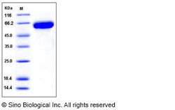 Sino Biological Influenza A H1N1 (A/WSN/1933) Hemagglutinin Protein (HA1