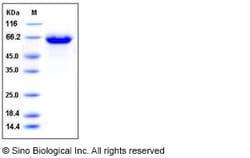Sino Biological Influenza A H10N3 (A/duck/Hong Kong/786/1979) Hemagglutinin