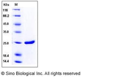 Sino Biological HIV-1 p24 Protein (group M, subtype B, strain 92418) (His