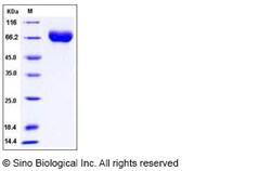 Sino Biological Influenza A H5N1 (A/Egypt/2321-NAMRU3/2007) Hemagglutinin