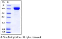 Sino Biological Influenza A H5N1 (A/duck/Hunan/795/2002) Hemagglutinin