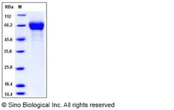 Sino Biological Influenza A H5N2 (A/American green-winged teal/California/HKWF609/2007)