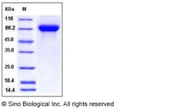 Sino Biological Influenza A H11N2 (A/duck/Yangzhou/906/2002) Hemagglutinin