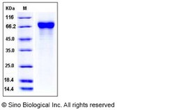 Sino Biological Influenza A H4N6 (A/Swine/Ontario/01911-1/99) Hemagglutinin