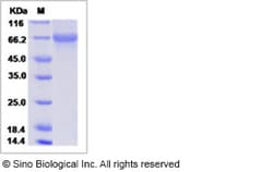 Sino Biological Influenza A H3N2 (A/Aichi/2/1968) Hemagglutinin / HA Protein