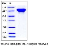 Sino Biological Influenza A H3N2 (A/Aichi/2/1968) Hemagglutinin Protein