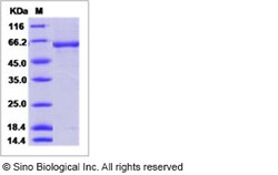 Sino Biological Influenza A H5N1 (A/Cambodia/R0405050/2007) Hemagglutinin