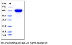 Sino Biological Influenza A H5N1 (A/Cambodia/R0405050/2007) Hemagglutinin