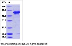Sino Biological Influenza A H16N3 (A/black-headed gull/Sweden/5/99) Hemagglutinin