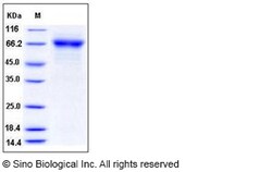 Sino Biological Influenza A H5N1 (A/chicken/India/NIV33487/06) Hemagglutinin