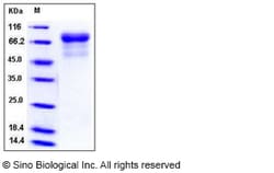 Sino Biological Influenza A H5N1 (A/Hong kong/213/2003) Hemagglutinin Protein