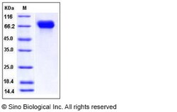 Sino Biological Influenza A H4N6 (A/mallard/Ohio/657/2002) Hemagglutinin