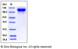 Sino Biological Influenza A H3N2 (A/Wyoming/03/2003) Hemagglutinin / HA
