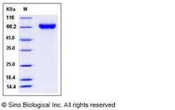 Sino Biological Influenza A H5N8 (A/duck/NY/191255-59/2002) Hemagglutinin
