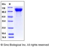 Sino Biological Influenza A H12N5 (A/green-winged teal/ALB/199/1991) Hemagglutinin