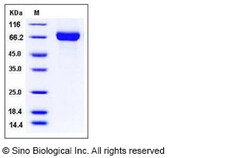 Sino Biological Influenza A H9N2 (A/Guinea fowl/Hong Kong/WF10/99) Hemagglutinin