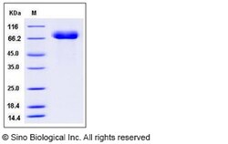 Sino Biological Influenza A H15N8 (A/duck/AUS/341/1983) Hemagglutinin /