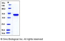 Sino Biological Recombinant Human LOK Protein (His Tag), Quantity: Each