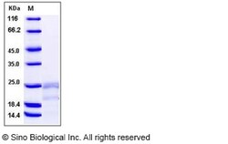Sino Biological Human IFN-gamma / IFNG / γ-IFN Protein 1mg, Quantity: Each