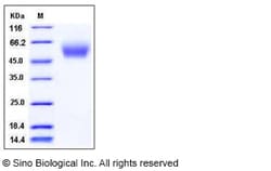 Sino Biological Recombinant Human CEACAM-8/CD66b Protein (His Tag), HPLC-verified,