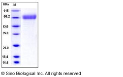 Sino Biological Human TEM7 / PLXDC1 Protein (His Tag) 50ug, Quantity: Each