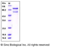 Sino Biological Recombinant Human CaMKII beta/CAMK2B Protein (His & GST
