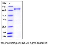 Sino Biological Recombinant Human PDE1B Protein (His & GST Tag), Quantity: