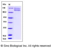 Sino Biological Recombinant Human IL-17RC Protein (hFc Tag), Quantity: