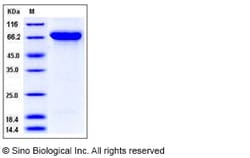 Sino Biological Recombinant Human Semaphorin 4A Protein (His Tag), HPLC-verified,