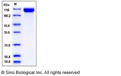 Sino Biological Recombinant Human DPP10 Protein (His Tag), Quantity: Each