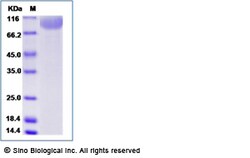 Sino Biological Human GP1BA Protein (His Tag) 50ug, Quantity: Each of 1