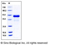 Sino Biological Recombinant Human CALML5 Protein (His & GST Tag), Quantity: