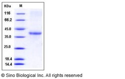 Sino Biological Recombinant Human ACRV1 Protein (His Tag), Quantity: Each