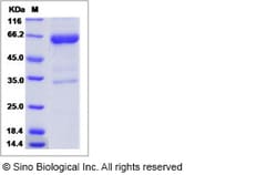 Sino Biological Recombinant Human M-CSF/CSF1 Protein (hFc Tag), Quantity: