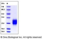 Sino Biological Recombinant Human M-CSF/CSF1 Protein (His Tag), Quantity: