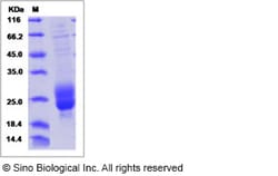 Sino Biological Recombinant Human M-CSF/CSF1 Protein, Quantity: Each of