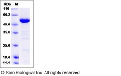 Sino Biological Recombinant Human HDAC4 Protein (aa 612-1084), Quantity: