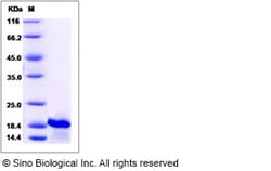 Sino Biological Human IL7 / interleukin 7 Protein 10ug, Quantity: Each