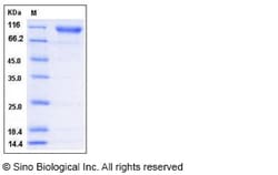 Sino Biological Human Semaphorin 4D / SEMA4D / CD100 Protein (His Tag)