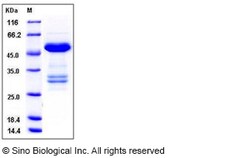 Sino Biological Human TWF1 / PTK9 / Twinfilin-1 Protein (His & GST Tag)