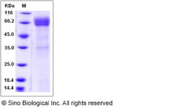 Sino Biological Human CD1B / CD1A Protein (Fc Tag) 100ug, Quantity: Each