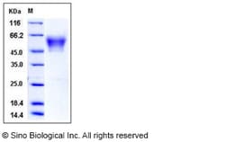 Sino Biological Recombinant Human Neurexin-3 beta/NRXN3 Protein (His Tag),