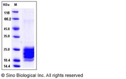 Sino Biological Human IL-9 / Interleukin-9 Protein (His Tag) 20ug, Quantity: