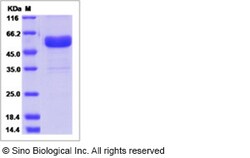 Sino Biological Recombinant Human EDA2R/TNFRSF27 Protein (hFc Tag), Quantity: