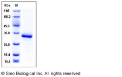 Sino Biological Recombinant Human EDA2R/TNFRSF27 Protein (His Tag), Quantity: