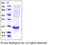 Sino Biological Recombinant Human IL-17F Protein (His Tag), Quantity: Each