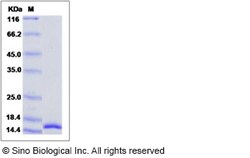Sino Biological Recombinant Human IL-17F Protein, Quantity: Each of 1
